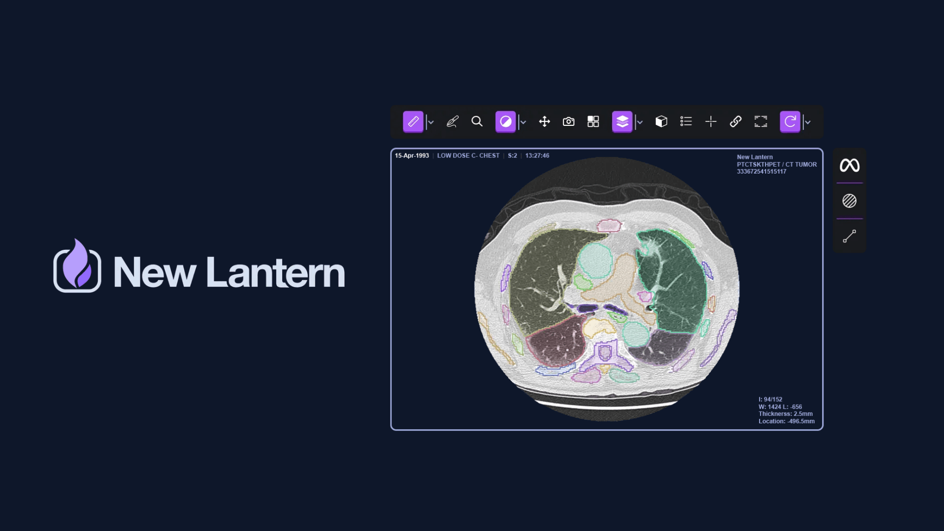 New Lantern, an artificial intelligence-supported health initiative, received an investment of $ 19 million