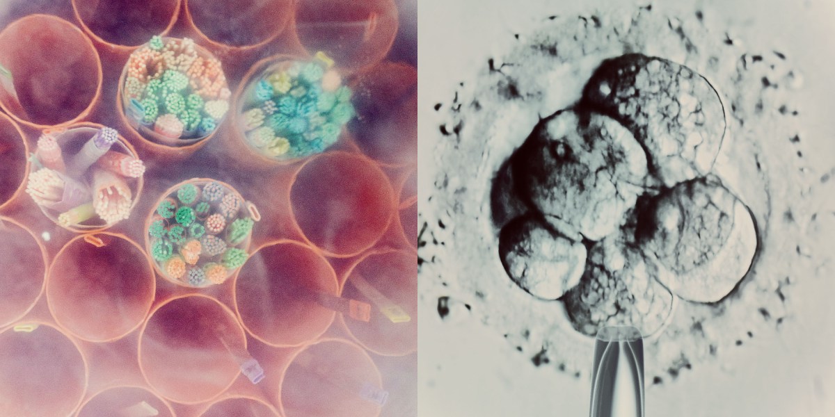 İndir: IVF embriyo belirsizliği ve AI ajanları üzerinde Antropik